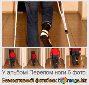 Фотобанк tOrange пропонує безкоштовні фото з розділу:  перелом-ноги